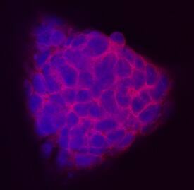 TEX19.1 was detected in immersion fixed D3 mouse embryonic stem cell line using Mouse TEX19.1 Monoclonal Antibody (Catalog # MAB6645) at 10 µg/mL for 3 hours at room temperature. Cells were stained using the NorthernLights™ 557-conjugated Anti-Rat IgG Secondary Antibody (red; Catalog # NL013) and counterstained with DAPI (blue). Specific staining was localized to cytoplasm. View our protocol for Fluorescent ICC Staining of Cells on Coverslips.