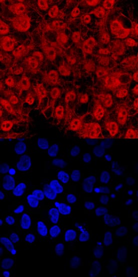 TEX19 was detected in immersion fixed BG01V human embryonic stem cells using Human TEX19 Antigen Affinity-purified Polyclonal Antibody (Catalog # AF6319) at 10 µg/mL for 3 hours at room temperature. Cells were stained using the NorthernLights™ 557-conjugated Anti-Sheep IgG Secondary Antibody (red, upper panel; Catalog # NL010) and counterstained with DAPI (blue, lower panel). Specific staining was localized to nuclei and cytoplasm. View our protocol for Fluorescent ICC Staining of Cells on Coverslips.
