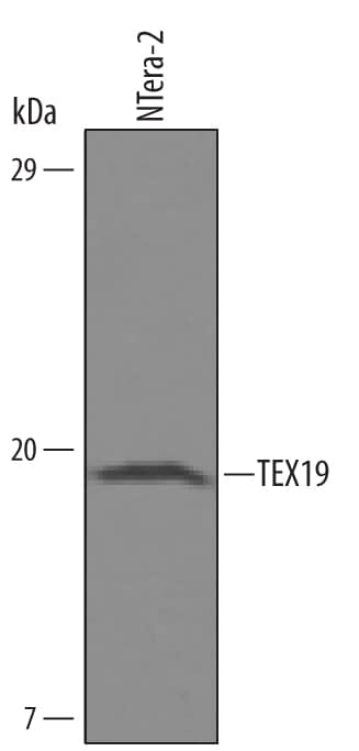 Western blot shows lysates of NTera-2 human testicular embryonic carcinoma cell line. PVDF Membrane was probed with 0.5 µg/mL of Human TEX19 Antigen Affinity-purified Polyclonal Antibody (Catalog # AF6319) followed by HRP-conjugated Anti-Sheep IgG Secondary Antibody (Catalog # HAF016). A specific band was detected for TEX19 at approximately 18 kDa (as indicated). This experiment was conducted under reducing conditions and using Immunoblot Buffer Group 8.