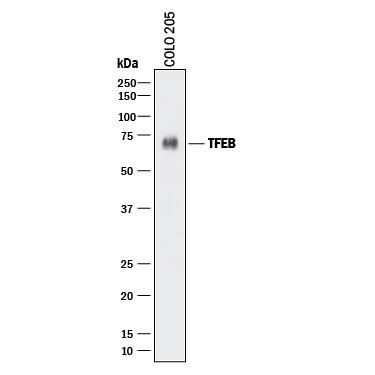 Western blot shows lysates of COLO 205 human colorectal adenocarcinoma cell line. PVDF membrane was probed with 2 µg/mL of Mouse Anti-Human TFEB Monoclonal Antibody (Catalog # MAB91701) followed by HRP-conjugated Anti-Mouse IgG Secondary Antibody (Catalog # HAF018). A specific band was detected for TFEB at approximately 70 kDa (as indicated). This experiment was conducted under reducing conditions and using Immunoblot Buffer Group 1.