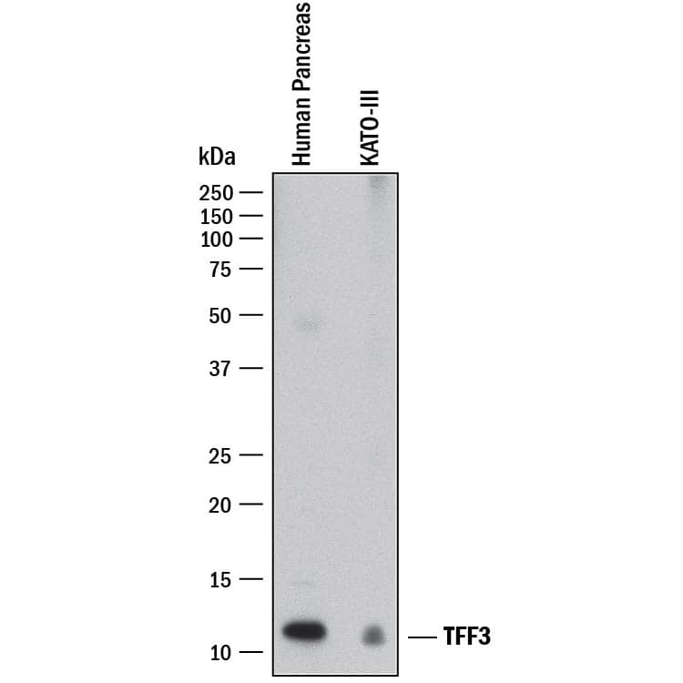 Western blot shows lysates of human pancreas tissue and KATO-III human gastric carcinoma cell line. PVDF membrane was probed with 1 µg/mL of Sheep Anti-Human TFF3 Antigen Affinity-purified Polyclonal Antibody (Catalog # AF4407) followed by HRP-conjugated Anti-Sheep IgG Secondary Antibody (Catalog # HAF016). A specific band was detected for TFF3 at approximately 12 kDa (as indicated). This experiment was conducted under reducing conditions and using Immunoblot Buffer Group 1.