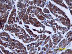 Immunohistochemistry TGF-beta 3 Antibody (44922)