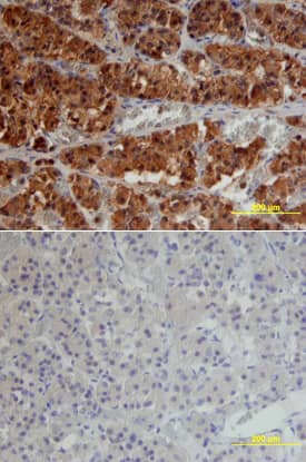 Immunohistochemistry TGF-beta RII Antibody [Unconjugated]