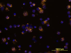 Immunocytochemistry TGF-beta RI/ALK-5 Antibody [Unconjugated]