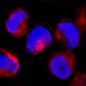 LAP (TGF-beta 1) was detected in immersion fixed K562 human chronic myelogenous leukemia cell line using Mouse Anti-Human LAP (TGF-beta 1) Monoclonal Antibody (Catalog # MAB77541) at 8 µg/mL for 3 hours at room temperature. Cells were stained using the NorthernLights™ 557-conjugated Anti-Mouse IgG Secondary Antibody (red; Catalog # NL007) and counterstained with DAPI (blue). Specific staining was localized to cytoplasm. View our protocol for Fluorescent ICC Staining of Cells on Coverslips.