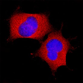 LAP (TGF-beta 1) was detected in immersion fixed HEK293 human embryonic kidney cell line using Mouse Anti-Human LAP (TGF-beta 1) Monoclonal Antibody (Catalog # MAB77541) at 8 µg/mL for 3 hours at room temperature. Cells were stained using the NorthernLights™ 557-conjugated Anti-Mouse IgG Secondary Antibody (red; Catalog # NL007) and counterstained with DAPI (blue). Specific staining was localized to cytoplasm. View our protocol for Fluorescent ICC Staining of Cells on Coverslips.