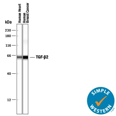 Simple Western lane view shows lysates of human heart tissue and human breast cancer tissue, loaded at 0.2 mg/mL. A specific band was detected for TGF-beta 2 at approximately 63 kDa (as indicated) using 2.5 µg/mL of Goat Anti-TGF-beta 2 Polyclonal Antibody (Catalog # AB-112-NA) followed by 1:50 dilution of HRP-conjugated Anti-Goat IgG Secondary Antibody (Catalog # HAF109). This experiment was conducted under reducing conditions and using the 12-230 kDa separation system.