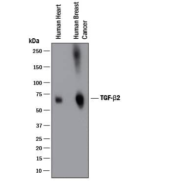 Western blot shows lysates of human heart tissue and human breast cancer tissue. PVDF membrane was probed with 0.25 µg/mL of Goat Anti-TGF-beta 2 Polyclonal Antibody (Catalog # AB-112-NA) followed by HRP-conjugated Anti-Goat IgG Secondary Antibody (Catalog # HAF017). A specific band was detected for TGF-beta 2 at approximately 70 kDa (as indicated). This experiment was conducted under reducing conditions and using Immunoblot Buffer Group 1.