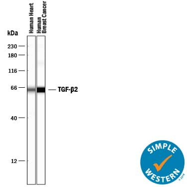 Simple Western lane view shows lysates of human heart tissue and human breast cancer tissue, loaded at 0.2 mg/mL. A specific band was detected for TGF‑ beta 2 at approximately 64 kDa (as indicated) using 5 µg/mL of Rabbit Anti-TGF‑ beta 2 Polyclonal Antibody (Catalog # AB-12-NA). This experiment was conducted under reducing conditions and using the 12-230 kDa separation system.