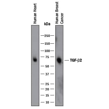 Western blot shows lysates of human heart tissue and human breast cancer tissue. PVDF membrane was probed with 0.1 µg/mL of Rabbit Anti-TGF-beta 2 Polyclonal Antibody (Catalog # AB-12-NA) followed by HRP-conjugated Anti-Rabbit IgG Secondary Antibody (Catalog # HAF008). A specific band was detected for TGF-beta 2 at approximately 70 kDa (as indicated). This experiment was conducted under reducing conditions and using Immunoblot Buffer Group 1.