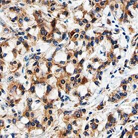 Immunohistochemistry TGF-beta 3 Antibody (20724) [Unconjugated]