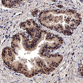 TGF-beta  was detected in immersion fixed paraffin-embedded sections of human prostate tissue using Rabbit Anti-TGF-beta  Pan Specific Polyclonal Antibody (Catalog # AB-100-NA) at 3 µg/mL for 1 hour at room temperature followed by incubation with the Anti-Rabbit IgG VisUCyte™ HRP Polymer Antibody (Catalog # VC003). Before incubation with the primary antibody, tissue was subjected to heat-induced epitope retrieval using Antigen Retrieval Reagent-Basic (Catalog # CTS013). Tissue was stained using DAB (brown) and counterstained with hematoxylin (blue). Specific staining was localized to cytoplasm in epitjhelial cells. View our protocol for IHC Staining with VisUCyte HRP Polymer Detection Reagents.