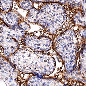 Immunohistochemistry TGF-beta RIII Antibody [Unconjugated]