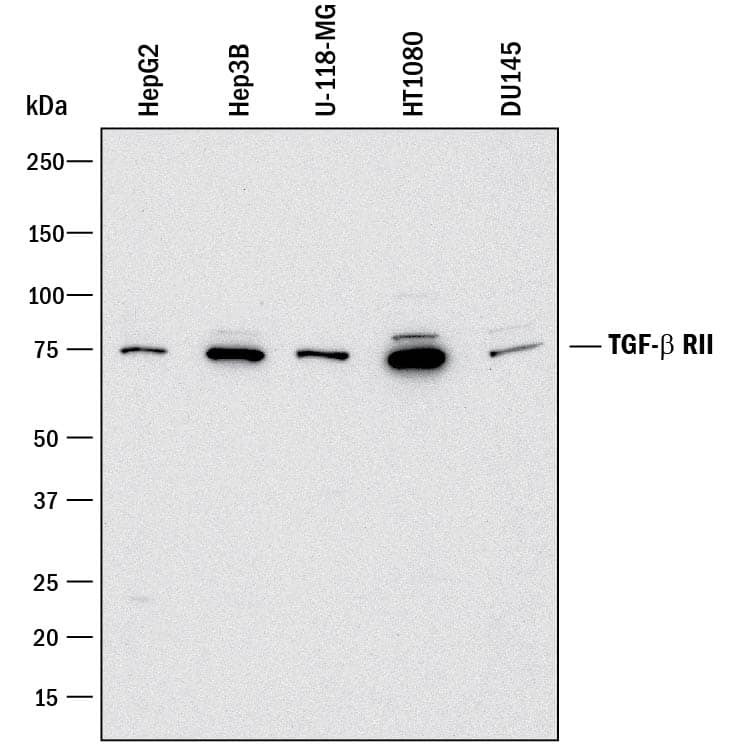 Western Blot TGF-beta RII Antibody [Unconjugated]