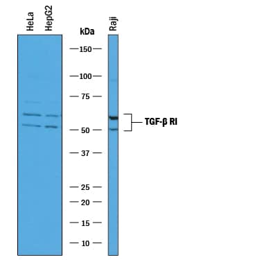 Western blot shows lysates of HeLa human cervical epithelial carcinoma cell line, HepG2 human hepatocellular carcinoma cell line, and Raji human Burkitt's lymphoma cell line. PVDF membrane was probed with 0.2 µg/mL of Goat Anti-Human TGF-beta  RI/ALK-5 Antigen Affinity-purified Polyclonal Antibody (Catalog # AF3025) followed by HRP-conjugated Anti-Goat IgG Secondary Antibody (Catalog # HAF019). Specific bands were detected for TGF-beta  RI/ALK-5 at approximately 50 & 56 kDa (as indicated). This experiment was conducted under reducing conditions and using Immunoblot Buffer Group 1.
