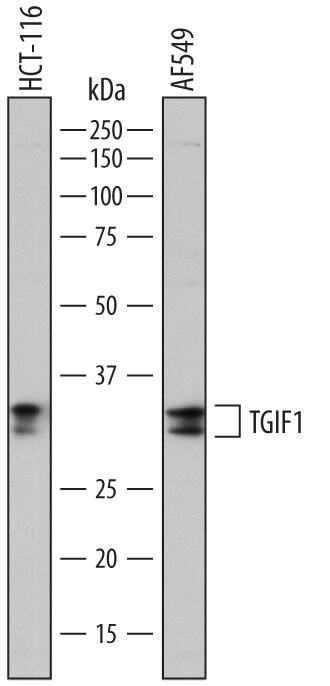 Western blot shows lysates of HCT-116 human colorectal carcinoma cell line and A549 human lung carcinoma cell line. PVDF membrane was probed with 0.5 µg/mL of Sheep Anti-Human TGIF1 Antigen Affinity-purified Polyclonal Antibody (Catalog # AF7555) followed by HRP-conjugated Anti-Sheep IgG Secondary Antibody (Catalog # HAF016). Specific bands were detected for TGIF1 at approximately 32-34 kDa (as indicated). This experiment was conducted under reducing conditions and using Immunoblot Buffer Group 1.