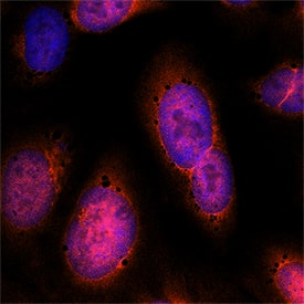 TIGAR/C12orf5 was detected in immersion fixed U2OS human osteosarcoma cell line using Sheep Anti-Human TIGAR/C12orf5 Antigen Affinity-purified Polyclonal Antibody (Catalog # AF7629) at 5 µg/mL for 3 hours at room temperature. Cells were stained using the NorthernLights™ 557-conjugated Anti-Sheep IgG Secondary Antibody (red; Catalog # NL010) and counterstained with DAPI (blue). Specific staining was localized to cytoplasm and nuclei. View our protocol for Fluorescent ICC Staining of Cells on Coverslips.
