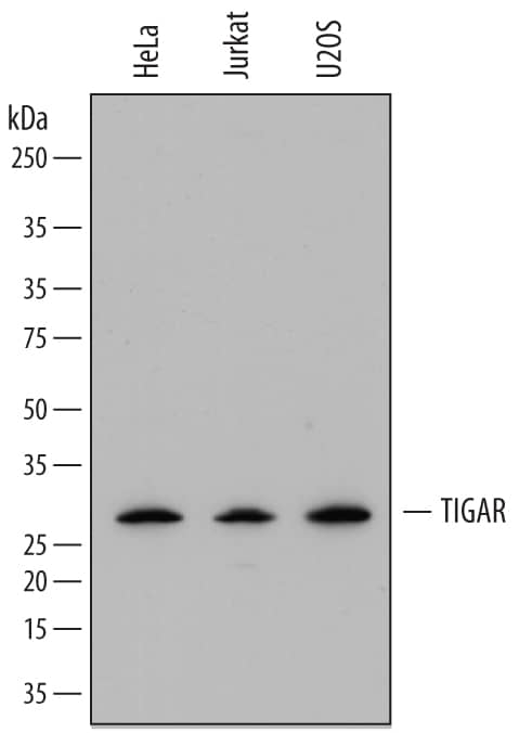 Western blot shows lysates of HeLa human cervical epithelial carcinoma cell line, Jurkat human acute T cell leukemia cell line, and U2OS human osteosarcoma cell line. PVDF membrane was probed with 0.5 µg/mL of Sheep Anti-Human TIGAR/C12orf5 Antigen Affinity-purified Polyclonal Antibody (Catalog # AF7629) followed by HRP-conjugated Anti-Sheep IgG Secondary Antibody (Catalog # HAF016). A specific band was detected for TIGAR/C12orf5 at approximately 30 kDa (as indicated). This experiment was conducted under reducing conditions and using Immunoblot Buffer Group 1.