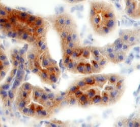 TIM-1/KIM-1/HAVCR was detected in perfusion fixed frozen sections of rat kidney using 15 µg/mL Rat TIM-1/KIM-1/HAVCR Antigen Affinity-purified Polyclonal Antibody (Catalog # AF3689) overnight at 4 °C. Tissue was stained with the Anti-Goat HRP-DAB Cell & Tissue Staining Kit (brown; Catalog # CTS008) and counterstained with hematoxylin (blue). View our protocol for Chromogenic IHC Staining of Frozen Tissue Sections.