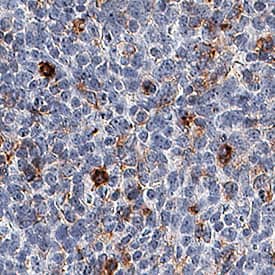 Immunohistochemistry TIM-3 Antibody [Unconjugated]