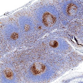 TIM-3 was detected in immersion fixed paraffin-embedded sections of human tonsil using Rabbit Anti-Human TIM-3 Monoclonal Antibody (Catalog # MAB23652) at 3 µg/mL for 1 hour at room temperature followed by incubation with the Anti-Rabbit IgG VisUCyte™ HRP Polymer Antibody (Catalog # VC003). Before incubation with the primary antibody, tissue was subjected to heat-induced epitope retrieval using Antigen Retrieval Reagent-Basic (Catalog # CTS013). Tissue was stained using DAB (brown) and counterstained with hematoxylin (blue). Specific staining was localized to cytoplasm in lymphocytes. View our protocol for IHC Staining with VisUCyte HRP Polymer Detection Reagents.