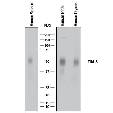 Western blot shows lysates of human spleen tissue, human tonsil tissue, and human thymus tissue. PVDF membrane was probed with 2 µg/mL of Rabbit Anti-Human TIM-3 Monoclonal Antibody (Catalog # MAB23652) followed by HRP-conjugated Anti-Rabbit IgG Secondary Antibody (Catalog # HAF008). A specific band was detected for TIM-3 at approximately 45-70 kDa (as indicated). This experiment was conducted under reducing conditions and using Immunoblot Buffer Group 1.