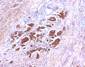 Immunohistochemistry TIMP-2 Antibody [Unconjugated]