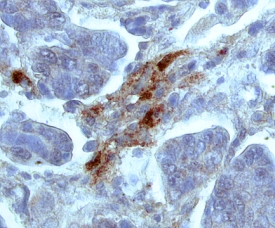 Immunohistochemistry TIMP-2 Antibody (89025) [Unconjugated]