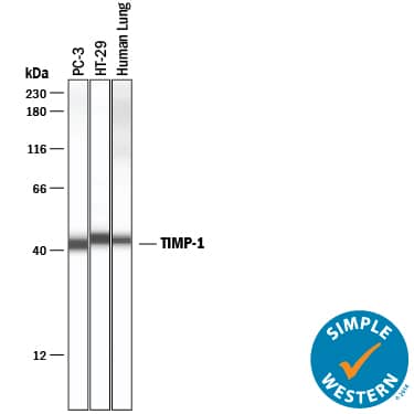 Simple Western lane view shows lysates of PC-3 human prostate cancer cell line, HT-29 human colon adenocarcinoma cell line, and human lung tissue, loaded at 0.2 mg/mL. A specific band was detected for TIMP-1 at approximately 42-45 kDa (as indicated) using 50 µg/mL of Goat Anti-Human TIMP-1 Antigen Affinity-purified Polyclonal Antibody (Catalog # AF970) followed by 1:50 dilution of HRP-conjugated Anti-Goat IgG Secondary Antibody (Catalog # HAF109). This experiment was conducted under reducing conditions and using the 12-230 kDa separation system.