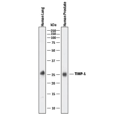 Western blot shows lysates of human lung tissue and human prostate tissue. PVDF membrane was probed with 1 µg/mL of Goat Anti-Human TIMP-1 Antigen Affinity-purified Polyclonal Antibody (Catalog # AF970) followed by HRP-conjugated Anti-Goat IgG Secondary Antibody (Catalog # HAF017). A specific band was detected for TIMP-1 at approximately 25 kDa (as indicated). This experiment was conducted under reducing conditions and using Immunoblot Buffer Group 1.