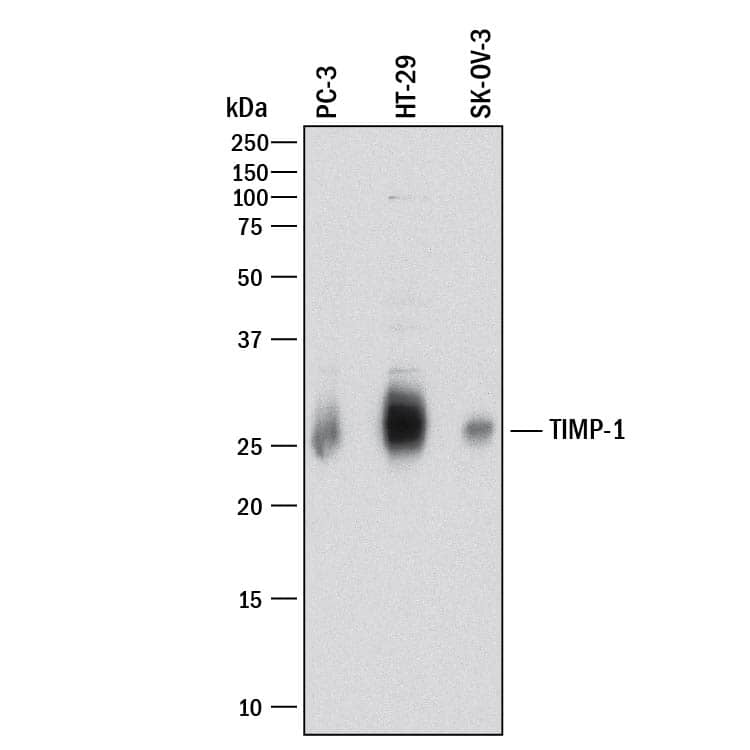 Western blot shows lysates of PC-3 human prostate cancer cell line, HT-29 human colon adenocarcinoma cell line, and SK-OV-3 human ovarian adenocarcinoma cell line. PVDF membrane was probed with 5 µg/mL of Goat Anti-Human TIMP-1 Antigen Affinity-purified Polyclonal Antibody (Catalog # AF970) followed by HRP-conjugated Anti-Goat IgG Secondary Antibody (Catalog # HAF017). A specific band was detected for TIMP-1 at approximately 26 kDa (as indicated). This experiment was conducted under reducing conditions and using Immunoblot Buffer Group 1.