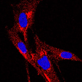 TIMP-1 was detected in immersion fixed Wi-38 human lung fibroblast cell line using Mouse Anti-Human TIMP-1 Monoclonal Antibody (Catalog # MAB970) at 3 µg/mL for 3 hours at room temperature. Cells were stained using the NorthernLights™ 557-conjugated Anti-Mouse IgG Secondary Antibody (red; Catalog # NL007) and counterstained with DAPI (blue). Specific staining was localized to cytoplasm and endoplasmic reticulum. View our protocol for Fluorescent ICC Staining of Cells on Coverslips.