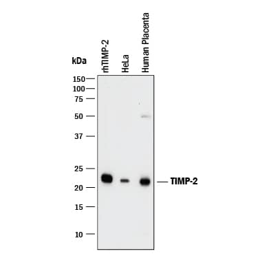 Western Blot TIMP-2 Antibody [Unconjugated]