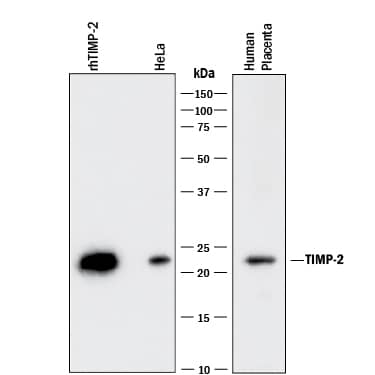 Western blot shows Recombinant Human TIMP-2 Western Blot Standard Protein (Catalog # WBC023) and lysates of HeLa human cervical epithelial carcinoma cell line and human placenta tissue. PVDF membrane was probed with 1 µg/mL of Goat Anti-Human TIMP-2 Monoclonal Antibody (Catalog # MAB97112) followed by HRP-conjugated Anti-Goat IgG Secondary Antibody (Catalog # HAF017). A specific band was detected for TIMP-2 at approximately 22 kDa (as indicated). This experiment was conducted under reducing conditions and using Immunoblot Buffer Group 1.