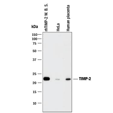 Western Blot TIMP-2 Antibody (89025) [Unconjugated]