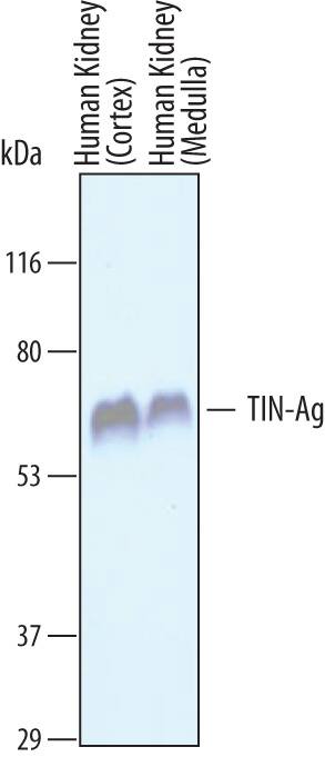 Western Blot TIN-Ag Antibody
