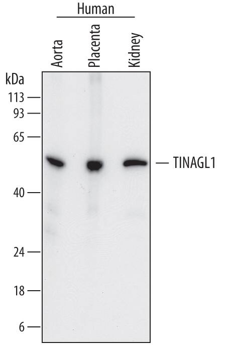 Western blot shows lysates of human aorta tissue, human placenta tissue, and human kidney tissue. PVDF membrane was probed with 0.25 µg/mL of Sheep Anti-Human TINAGL1 Antigen Affinity-purified Polyclonal Antibody (Catalog # AF7185) followed by HRP-conjugated Anti-Sheep IgG Secondary Antibody (Catalog # HAF016). A specific band was detected for TINAGL1 at approximately 55 kDa (as indicated). This experiment was conducted under reducing conditions and using Immunoblot Buffer Group 1.