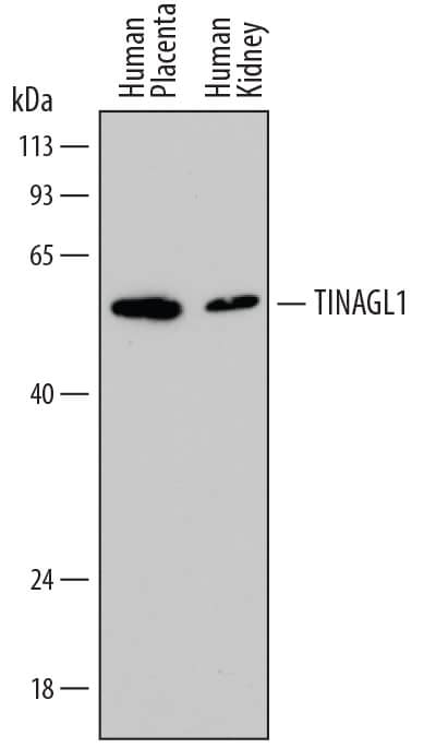 Western Blot TINAGL1 Antibody (812417)
