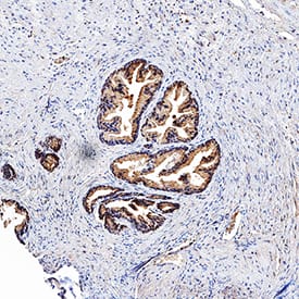 TL1A/TNFSF15 was detected in immersion fixed paraffin-embedded sections of human prostate using Goat Anti-Human TL1A/TNFSF15 Antigen Affinity-purified Polyclonal Antibody (Catalog # AF744) at 3 µg/mL for 1 hour at room temperature followed by incubation with the Anti-Goat IgG VisUCyte™ HRP Polymer Antibody (Catalog # VC004). Tissue was stained using DAB (brown) and counterstained with hematoxylin (blue). Specific staining was localized to epithelial cells. View our protocol for IHC Staining with VisUCyte HRP Polymer Detection Reagents.
