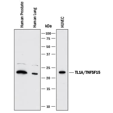 Western blot shows lysates of human prostate tissue, human lung tissue, and HUVEC human umbilical vein endothelial cells. PVDF membrane was probed with 1 µg/mL of Rabbit Anti-Human TL1A/ TNFSF15 Monoclonal Antibody (Catalog # MAB74421) followed by HRP-conjugated Anti-Rabbit IgG Secondary Antibody (Catalog # HAF008). A specific band was detected for TL1A/TNFSF15 at approximately 22 kDa (as indicated). This experiment was conducted under reducing conditions and using Immunoblot Buffer Group 1.