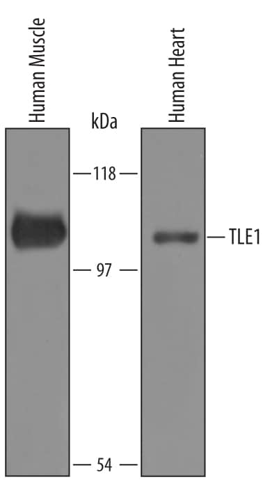 Western blot shows lysates of human muscle tissue and human heart tissue. PVDF Membrane was probed with 2 µg/mL of Human TLE1 Antigen Affinity-purified Polyclonal Antibody (Catalog # AF5947) followed by HRP-conjugated Anti-Sheep IgG Secondary Antibody (Catalog # HAF016). A specific band was detected for TLE1 at approximately 100 kDa (as indicated). This experiment was conducted under reducing conditions and using Immunoblot Buffer Group 8.