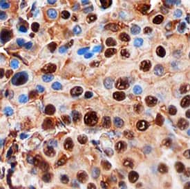 Immunohistochemistry TLE2 Antibody