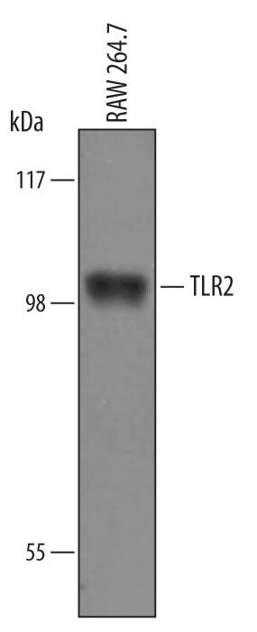 Western blot shows lysates of RAW 264.7 mouse monocyte/macrophage cell line. PVDF Membrane was probed with 1 µg/mL of Goat Anti-Mouse TLR2 Antigen Affinity-purified Polyclonal Antibody (Catalog # AF1530) followed by HRP-conjugated Anti-Goat IgG Secondary Antibody (Catalog # HAF019). A specific band was detected for TLR2 at approximately 100 kDa (as indicated). This experiment was conducted under reducing conditions and using Immunoblot Buffer Group 1.