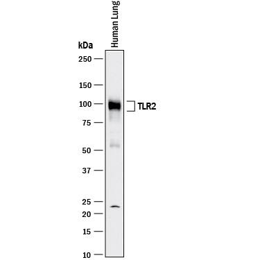 Western blot shows lysate of human lung tissue. PVDF membrane was probed with 1 µg/mL of Goat Anti-Human TLR2 Antigen Affinity-purified Polyclonal Antibody (Catalog # AF2616) followed by HRP-conjugated Anti-Goat IgG Secondary Antibody (Catalog # HAF017). A specific band was detected for TLR2 at approximately 90-100 kDa (as indicated). This experiment was conducted under reducing conditions and using Immunoblot Buffer Group 1.