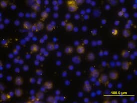 TLR4 was detected in immersion fixed human peripheral blood mononuclear cells (PBMCs) using Goat Anti-Human TLR4 Antigen Affinity-purified Polyclonal Antibody (Catalog # AF1478) at 10 µg/mL for 3 hours at room temperature. Cells were stained using the NorthernLights™ 557-conjugated Anti-Goat IgG Secondary Antibody (yellow; Catalog # NL001) and counterstained with DAPI (blue). View our protocol for Fluorescent ICC Staining of Non-adherent Cells.