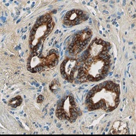 TLR4 was detected in immersion fixed paraffin-embedded sections of human prostate using Goat Anti-Human TLR4 Antigen Affinity-purified Polyclonal Antibody (Catalog # AF1478) at 10 &micro;g/mL overnight at 4 &deg;C. Before incubation with the primary antibody tissue was subjected to heat-induced epitope retrieval using Antigen Retrieval Reagent-Basic (Catalog # CTS013). Tissue was stained using the Anti-Goat HRP-DAB Cell & Tissue Staining Kit (brown; Catalog # CTS008) and counterstained with hematoxylin (blue). View our protocol for Chromogenic IHC Staining of Paraffin-embedded Tissue Sections.