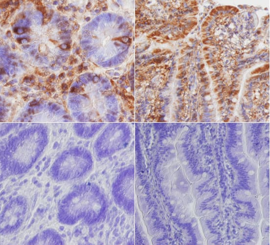 TLR5 was detected in immersion fixed paraffin-embedded sections of human intestine using Mouse Anti-Human TLR5 Monoclonal Antibody (Catalog # MAB6704) at 15 µg/mL overnight at 4 °C. Tissue was stained using the Anti-Mouse HRP-DAB Cell & Tissue Staining Kit (brown; Catalog # CTS002) and counterstained with hematoxylin (blue). Lower panels show a lack of labeling when primary antibodies are omitted and tissue is stained only with secondary antibody followed by incubation with detection reagents. Specific staining was localized to cell surfaces and cytoplasm. View our protocol for Chromogenic IHC Staining of Paraffin-embedded Tissue Sections.
