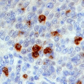 TLR9 was detected in immersion fixed paraffin-embedded sections of human tonsil using Sheep Anti-Human TLR9 Antigen Affinity-purified Polyclonal Antibody (Catalog # AF3658) at 1 µg/mL overnight at 4 °C. Tissue was stained using the Anti-Sheep HRP-DAB Cell & Tissue Staining Kit (brown; Catalog # CTS019) and counterstained with hematoxylin (blue). Specific staining was localized to membranes of lymphocytes. View our protocol for Chromogenic IHC Staining of Paraffin-embedded Tissue Sections.