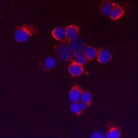 TLR9 was detected in immersion fixed mouse splenocytes using Mouse Anti-Human TLR9 Monoclonal Antibody (Catalog # MAB36581) at 3 µg/mL for 3 hours at room temperature. Cells were stained using the NorthernLights™ 557-conjugated Anti-Mouse IgG Secondary Antibody (red; NL007) and counterstained with DAPI (blue). Specific staining was localized to plasma membrane. View our protocol for Fluorescent ICC Staining of Non-adherent Cells.