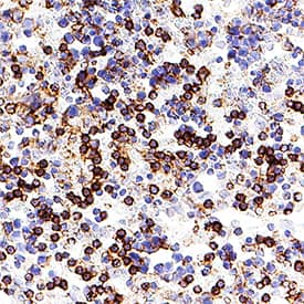 TLR9 was detected in perfusion fixed frozen sections of mouse spleen using Mouse Anti-Human TLR9 Monoclonal Antibody (Catalog # MAB36581) at 1.7 &micro;g/mL for 1 hour at room temperature followed by incubation with the Anti-Mouse IgG VisUCyte&trade; HRP Polymer Antibody (VC001). Tissue was stained using DAB (brown) and counterstained with hematoxylin (blue). Specific staining was localized to plasma membrane. View our protocol for IHC Staining with VisUCyte HRP Polymer Detection Reagents.